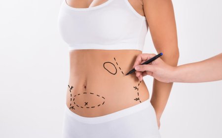 Everything You Need to Know About Mini Tummy Tuck Surgery in Dubai