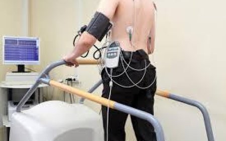 Treadmill Test Cost in Bangalore: Your Guide to Affordable Cardiac Health