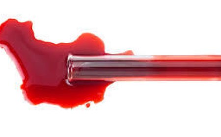 Home Blood Sample Collection: Hassle-Free Testing at Your Doorstep