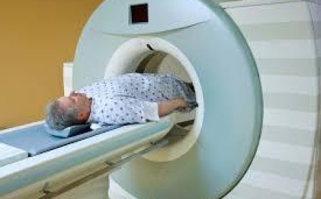 CT Scan Price in Bangalore: Complete Guide to Cost, Benefits & More