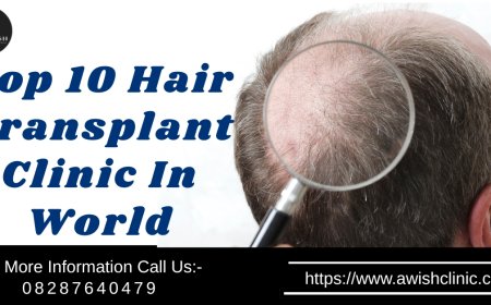 Top 10 Hair Transplant Clinics in the World Trusted by Experts in 2025