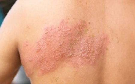 Understanding the Benefits of Ivermectin 3mg for Humans